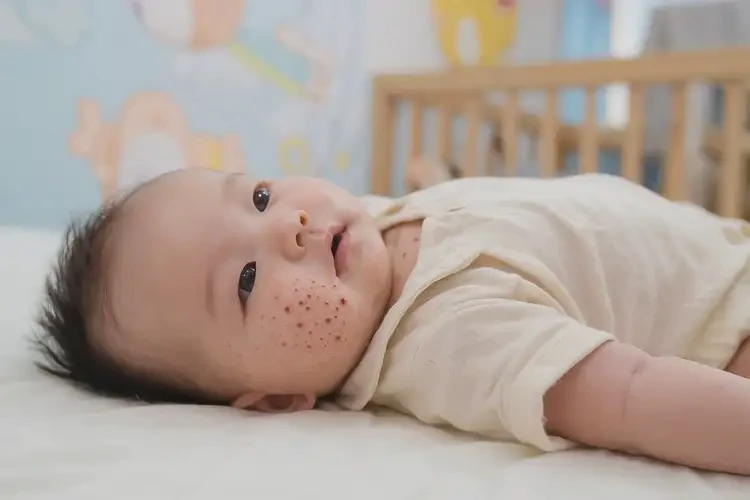 寶寶脖子偶爾長(zhǎng)濕疹可以徹底自愈嗎(圖3)