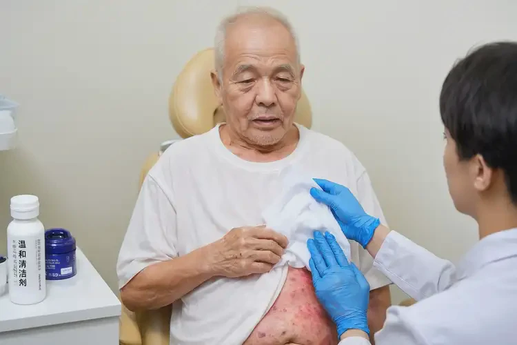 老年人肚子上偶爾長(zhǎng)濕疹不管它會(huì)自己自愈嗎(圖3)