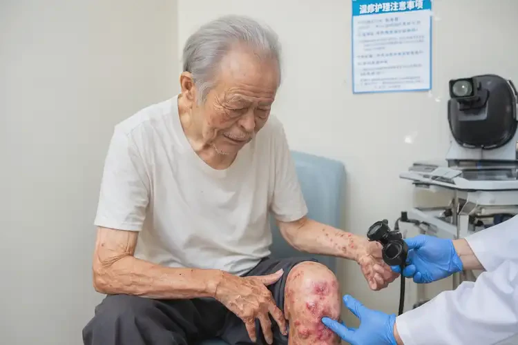 老年人小腿偶爾起濕疹能不能徹底自愈(圖4)