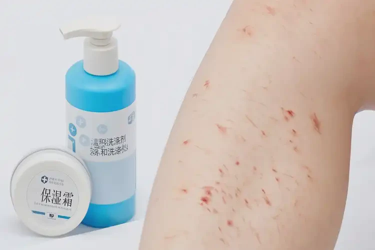 兒童小腿出現(xiàn)濕疹可不可以徹底自愈(圖3)