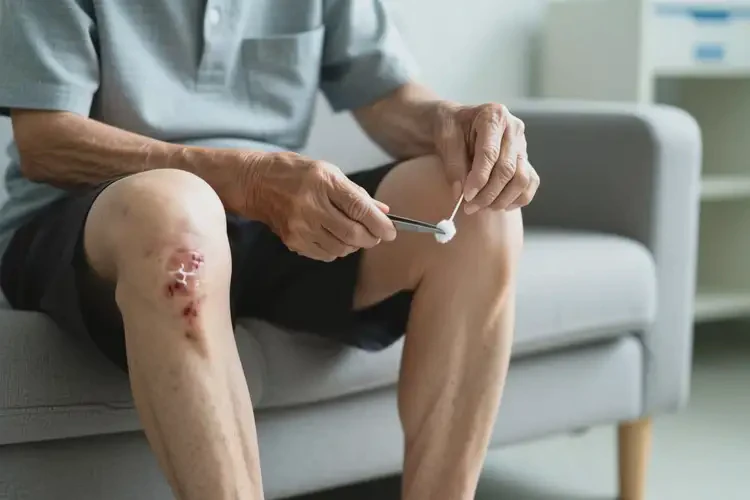 高齡老人四肢有濕疹能不能根治(圖1)