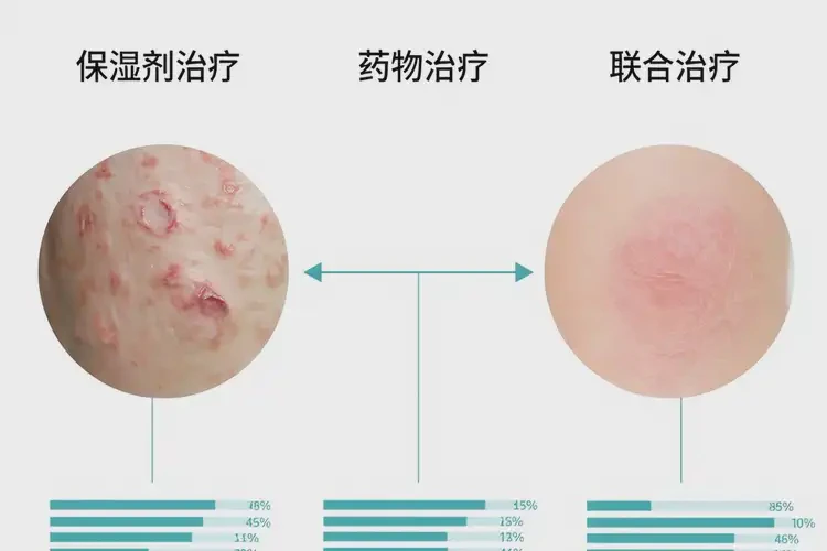 少兒手上出現(xiàn)濕疹能夠徹底治愈嗎(圖2)