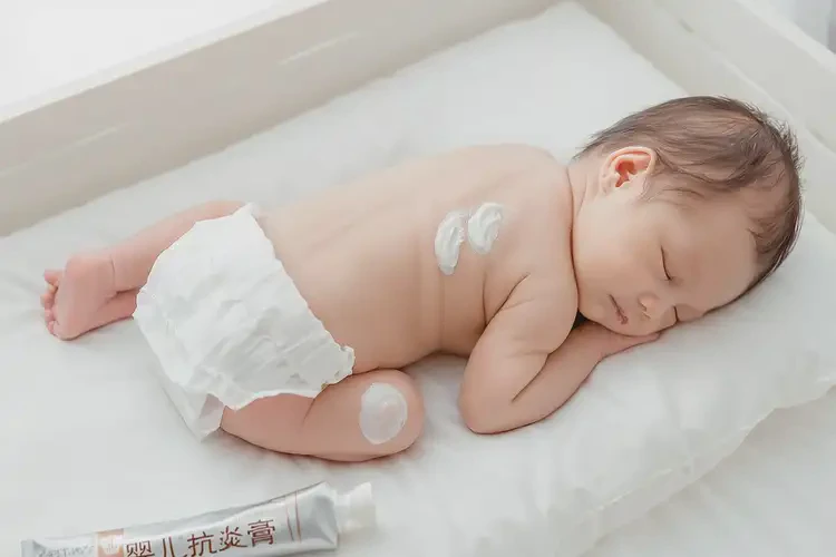 新生兒屁股上有濕疹能夠徹底治愈嗎(圖3)