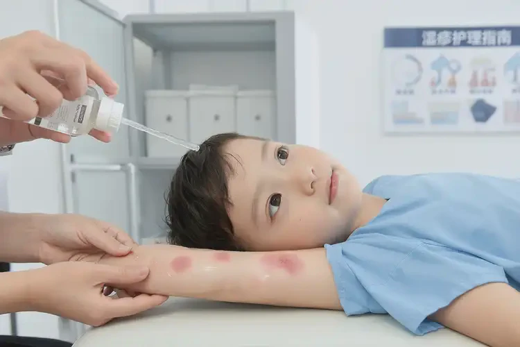 孩子全身偶爾長(zhǎng)濕疹不管它會(huì)自己自愈嗎(圖1)