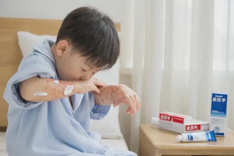 孩子屁股偶爾長濕疹可以徹底自愈嗎(圖2)