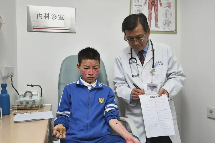 中學(xué)生面部有濕疹能不能徹底自愈(圖3)