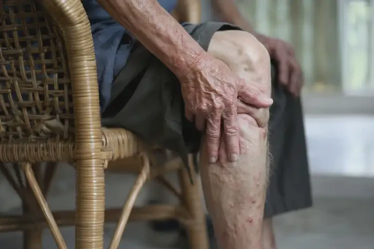 老年人小腿偶爾長濕疹不管它會(huì)自己痊愈嗎(圖4)