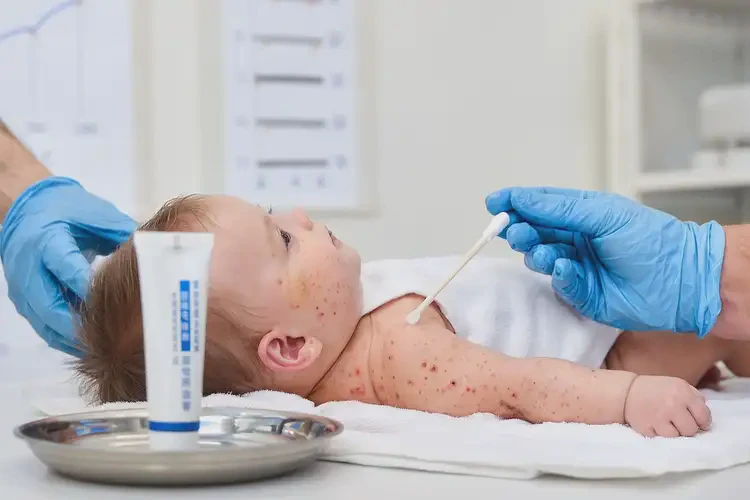 小兒脖子上出現(xiàn)濕疹不管它會(huì)自己好嗎(圖3)