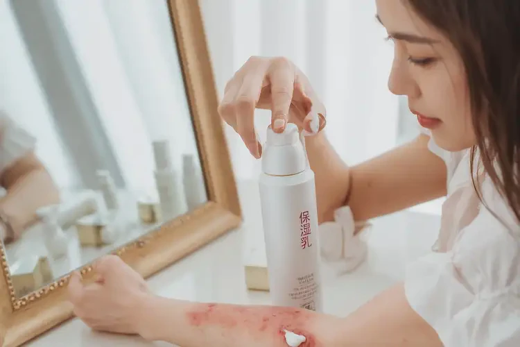 男人臉上起濕疹能不能根治(圖4)