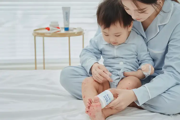 寶寶腳上出濕疹能徹底自愈嗎(圖3)