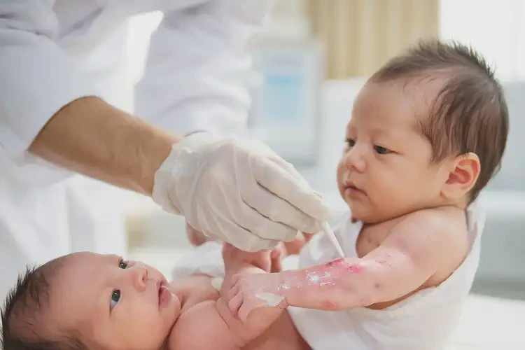 新生兒手臂上偶爾長濕疹能徹底自愈嗎(圖2)