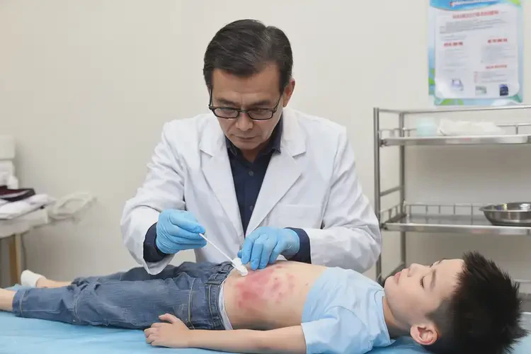 小孩肚子長濕疹可不可以根治(圖3)