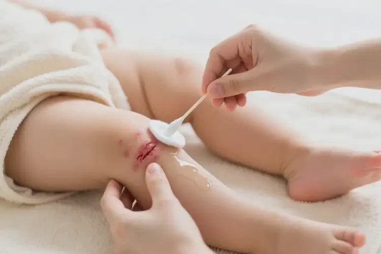 幼兒大腿起濕疹能夠徹底治愈嗎(圖3)