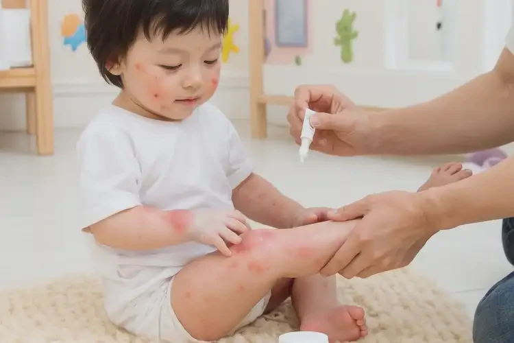 嬰幼兒四肢有濕疹可不可以根治(圖3)