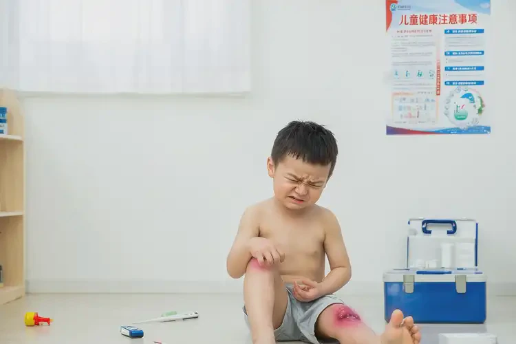 兒童大腿長濕疹不管它會自己痊愈嗎(圖3)