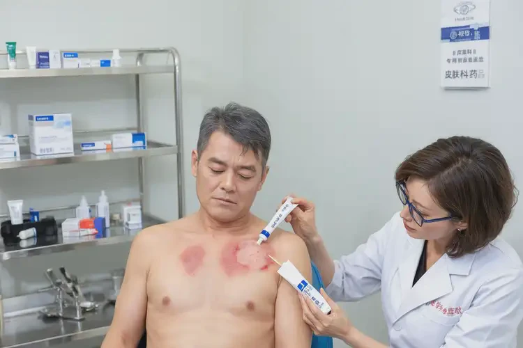 男性脖子容易長濕疹可不可以根治(圖3)