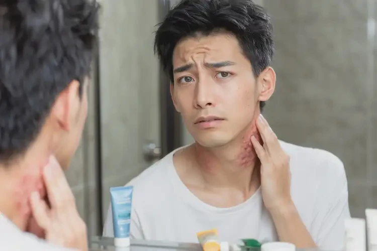男生脖子上有濕疹可以徹底自愈嗎(圖4)