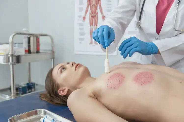 女生肚子長(zhǎng)濕疹可不可以根治(圖3)