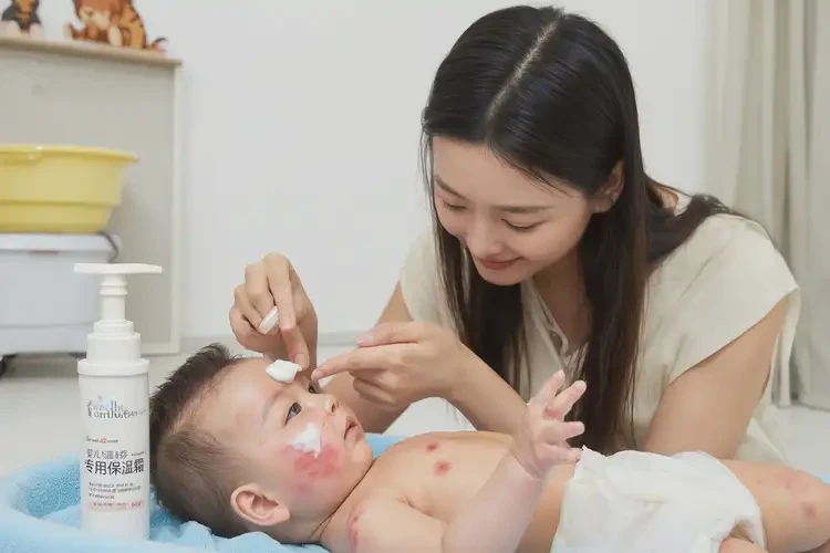 嬰兒全身長濕疹可不可以根治(圖3)