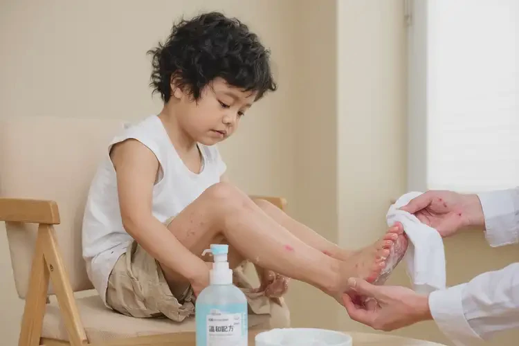 小兒腳上長濕疹可不可以根治(圖2)