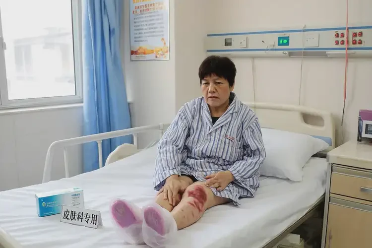 產(chǎn)婦大腿上容易長(zhǎng)濕疹可不可以根治(圖4)