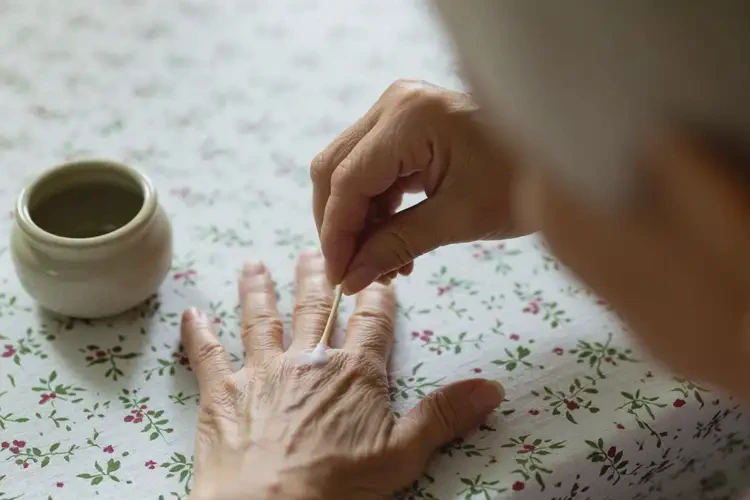 老人手上偶爾長濕疹可不可以根治(圖1)