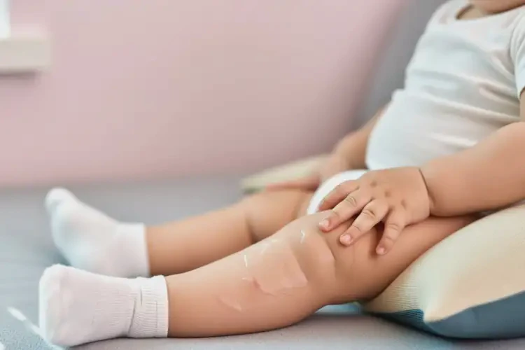 嬰兒大腿偶爾長濕疹可不可以根治(圖1)