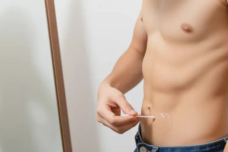 青少年肚子上容易長濕疹可不可以根治(圖2)