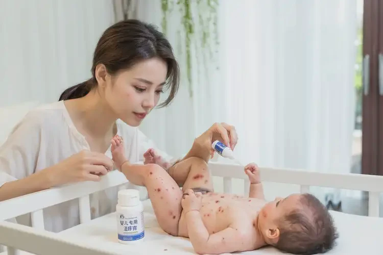 新生兒臉上經(jīng)常起濕疹能靠自己自愈嗎(圖2)