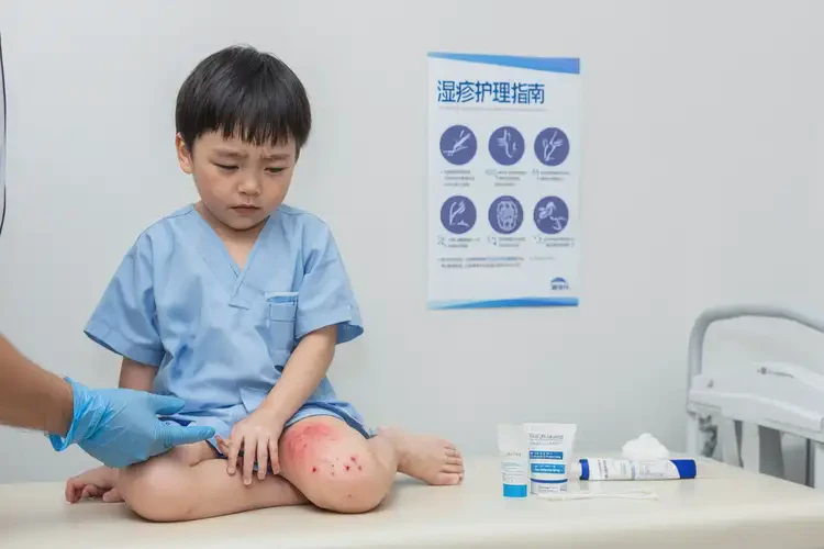 兒童屁股上容易起濕疹不管它會(huì)自己自愈嗎(圖4)