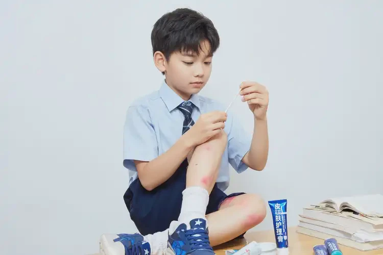 中學(xué)生腳上起濕疹能夠徹底治愈嗎(圖2)