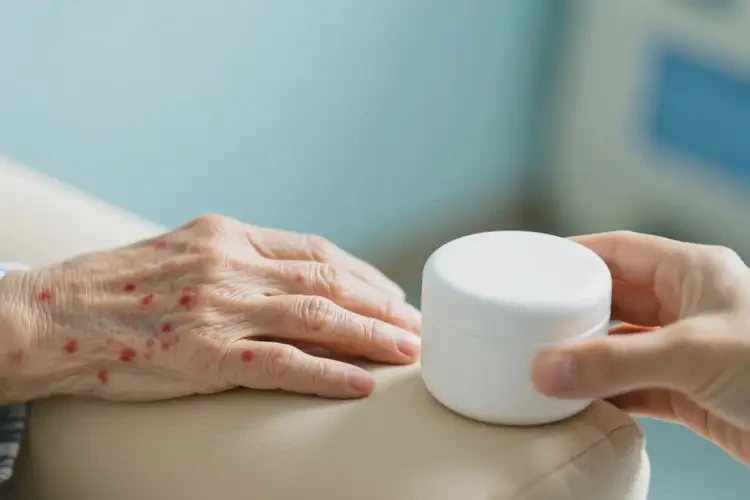 老人手臂上容易长湿疹可不可以根治(图3)