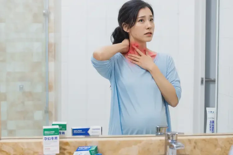 孕婦脖子上出現(xiàn)濕疹不管它會自己痊愈嗎(圖4)