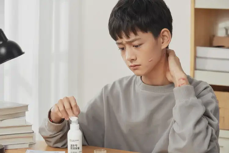 大學生脖子出濕疹可以徹底自愈嗎(圖4)