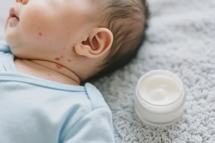 嬰幼兒脖子上出濕疹可不可以根治(圖3)