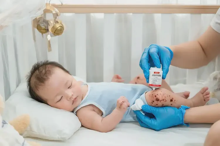 婴儿大腿上经常长湿疹不管它会自己自愈吗(图2)