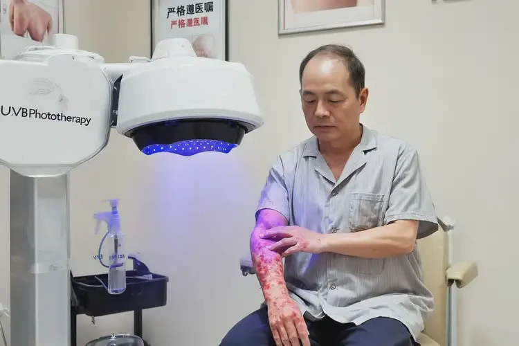 男生面部起濕疹可不可以根治(圖1)