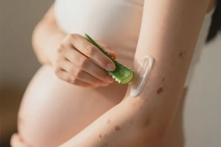 孕婦手臂容易起濕疹可不可以根治(圖4)