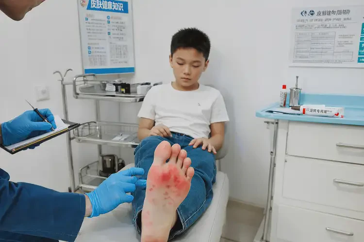 青少年腳上容易起濕疹不管它會自己自愈嗎(圖2)