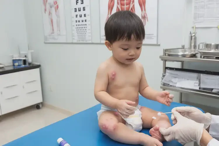 幼兒大腿經(jīng)常起濕疹可不可以根治(圖3)