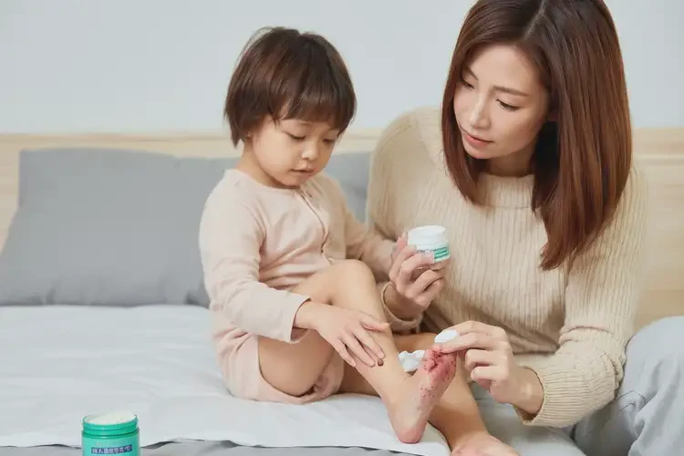 孩子腳上出濕疹能靠自己自愈嗎(圖3)