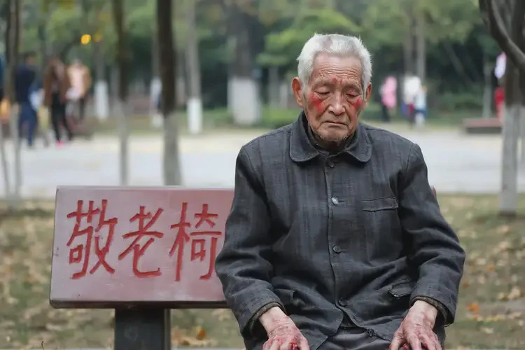 老人屁股上偶爾起濕疹不管它會自己好嗎(圖4)