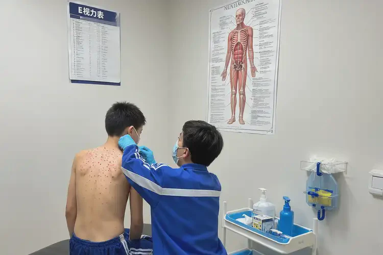 中學生肛周有濕疹可不可以根治(圖1)