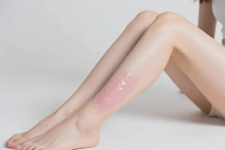 女生小腿出濕疹可不可以根治(圖3)