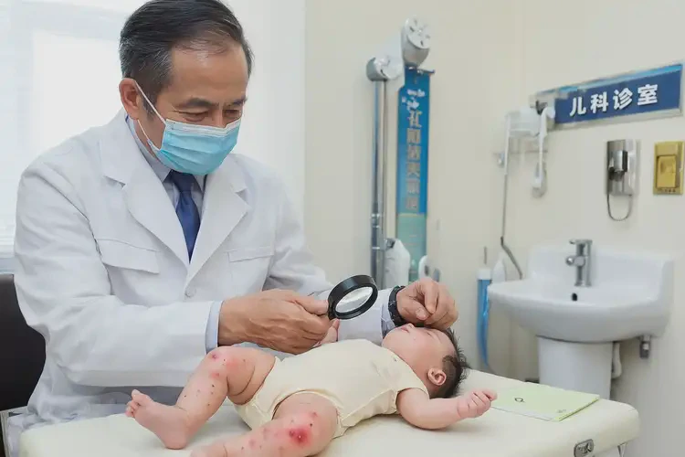 嬰幼兒屁股容易長濕疹可不可以根治(圖1)