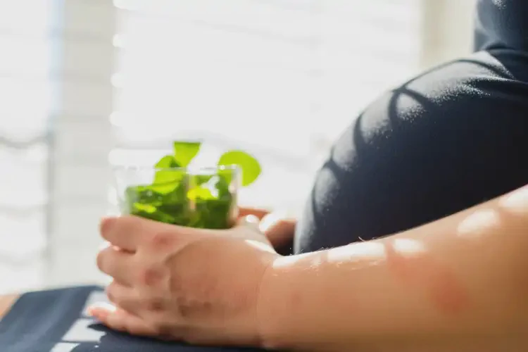 產婦手臂上出現(xiàn)濕疹能徹底自愈嗎(圖2)