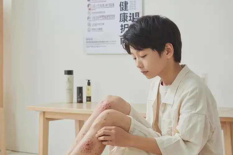 青少年大腿上容易长湿疹能不能彻底自愈(图1)