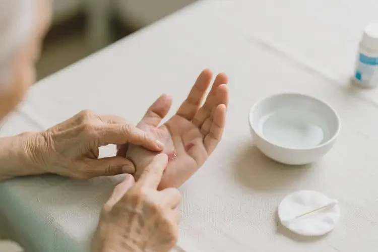 老年人全身容易起濕疹可不可以根治(圖2)