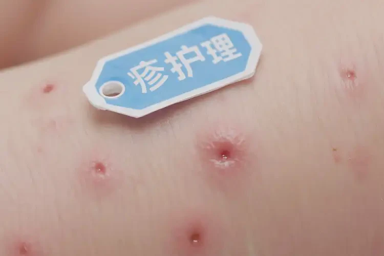 新生兒四肢經(jīng)常長(zhǎng)濕疹可不可以根治(圖4)