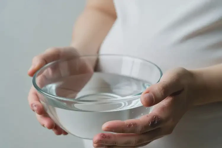 產(chǎn)婦手上偶爾長(zhǎng)濕疹可不可以根治(圖2)